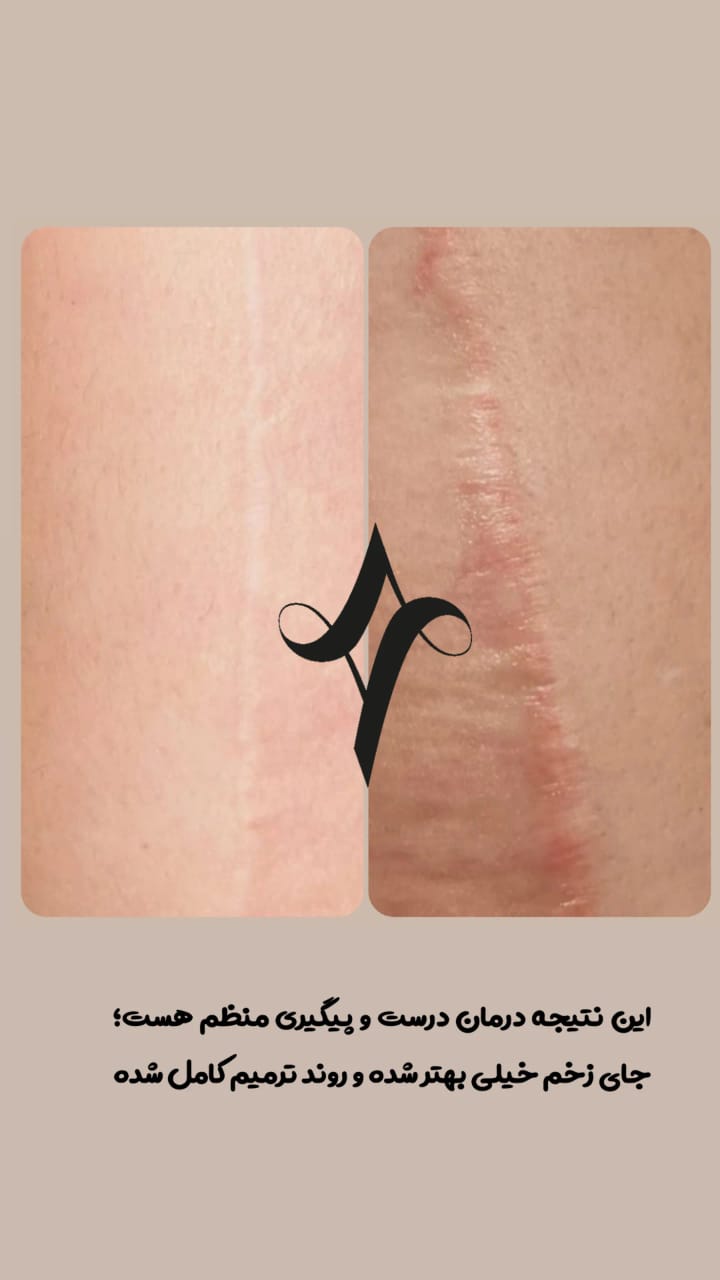 خدمات پاکسازی و درمان پوست یلدا اکبری در شیراز